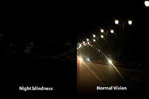 Nyctalopia/Night Blindness