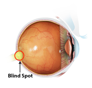 https://www.retinasocal.com/3d-images/blind-spot.jpg