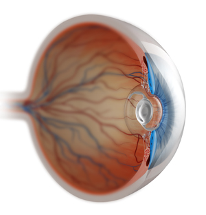 Cataract Surgery in Diabetics