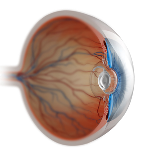 Cataract Surgery in Diabetics