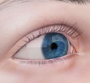 Repair of Conjunctival & Corneal Tear